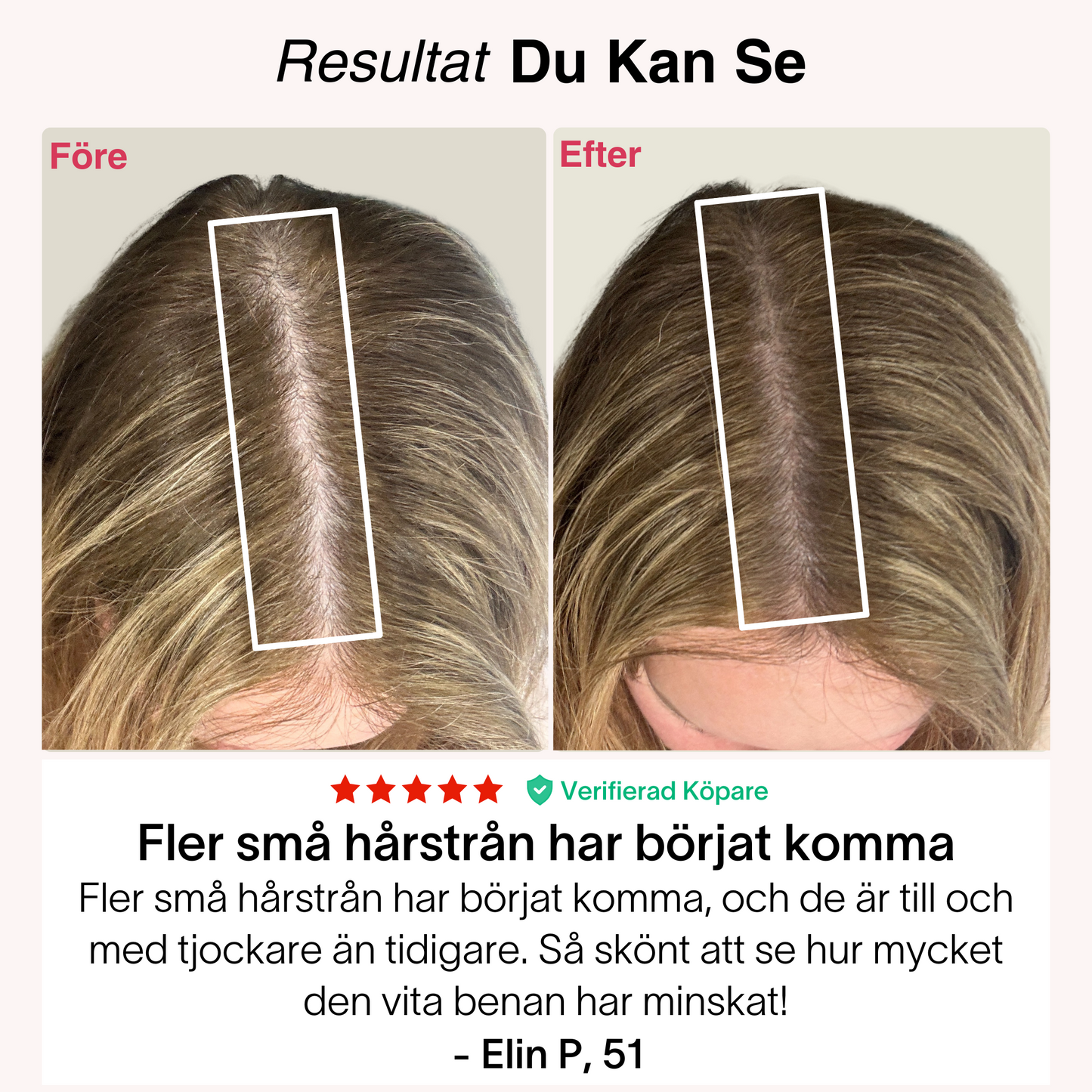 Rødljus-Kepsen® | Laserterapi til hårbund og vækst⁠