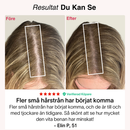 Rødljus-Kepsen® | Laserterapi til hårbund og vækst⁠