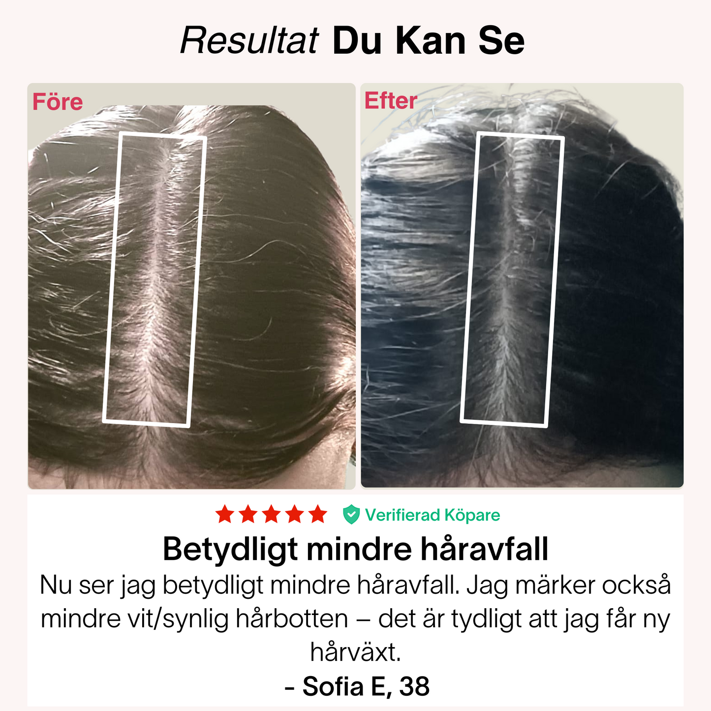 Rødljus-Kepsen® | Laserterapi til hårbund og vækst⁠