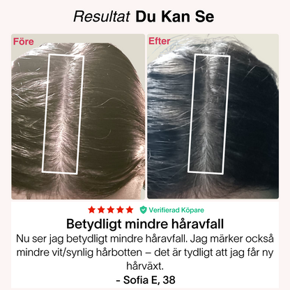 Rødljus-Kepsen® | Laserterapi til hårbund og vækst⁠